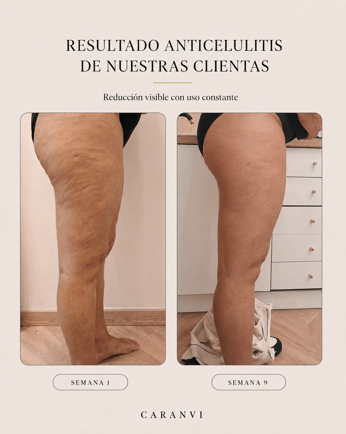Aceite Anticelulítico y Reafirmante Caranvi | 4 en 1
