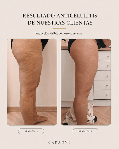 Aceite Anticelulítico y Reafirmante Caranvi | 4 en 1