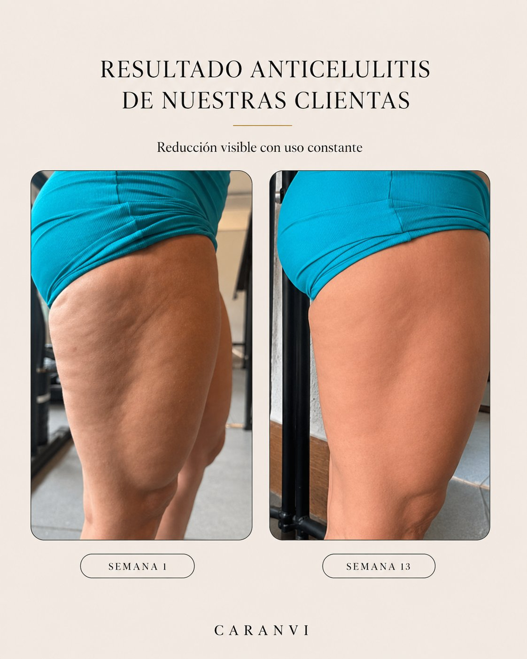 Aceite Anticelulítico y Reafirmante Caranvi | 4 en 1