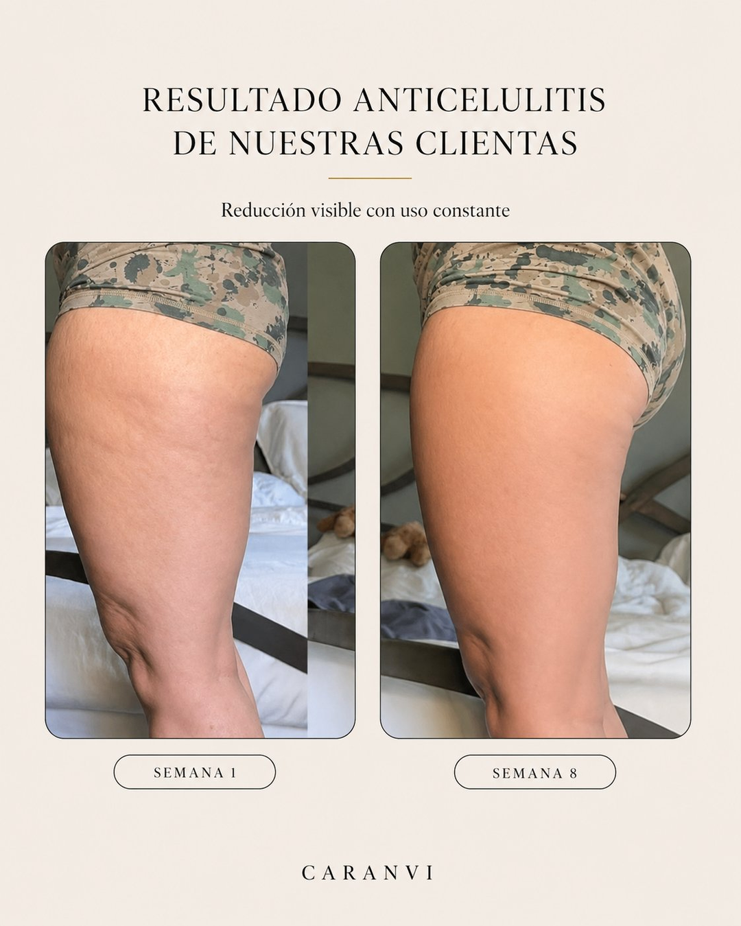 Aceite Anticelulítico y Reafirmante Caranvi | 4 en 1