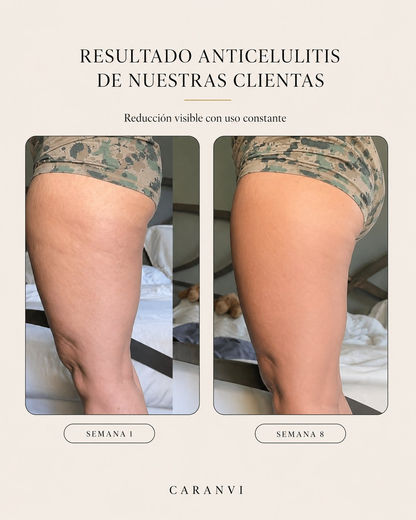 Aceite Anticelulítico y Reafirmante Caranvi | 4 en 1